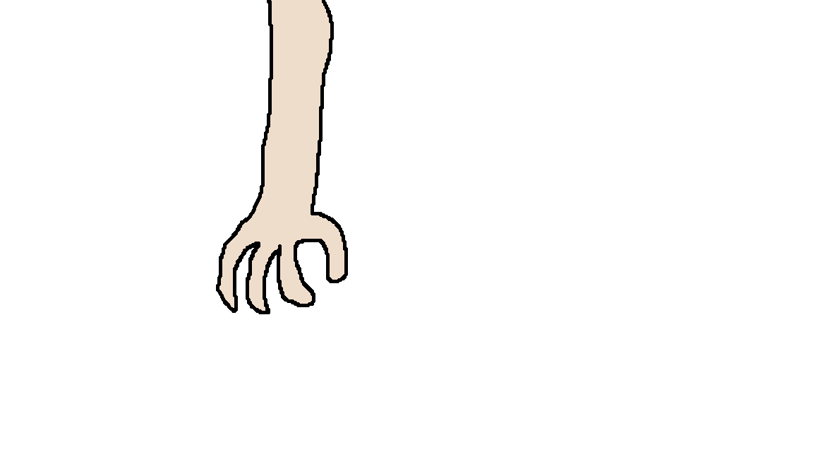 Melvin's Arm